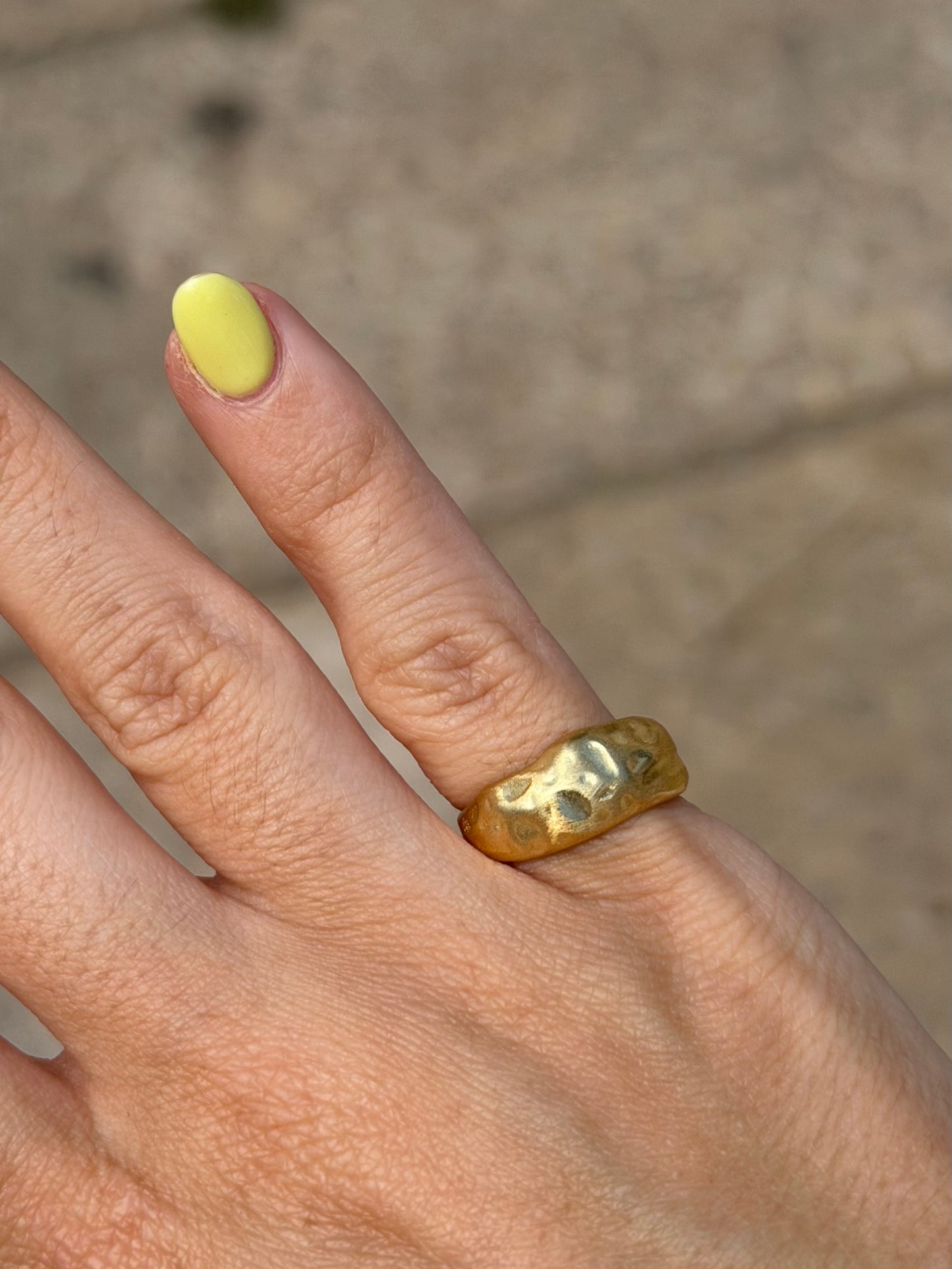 Anillo dol